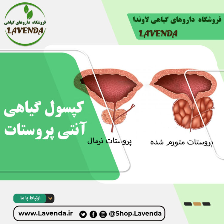 کپسول گیاهی آنتی پروستات
