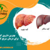 بهترین داروی گیاهی برای درمان سریع کبد چرب
