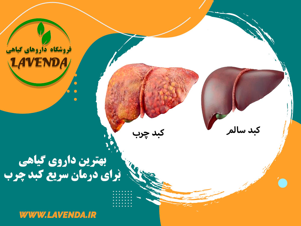داروی گیاهی کبد چرب | فروشگاه لاوندا