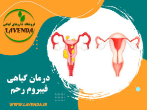 درمان فیبروم رحم با داروهای گیاهی و طب سنتی